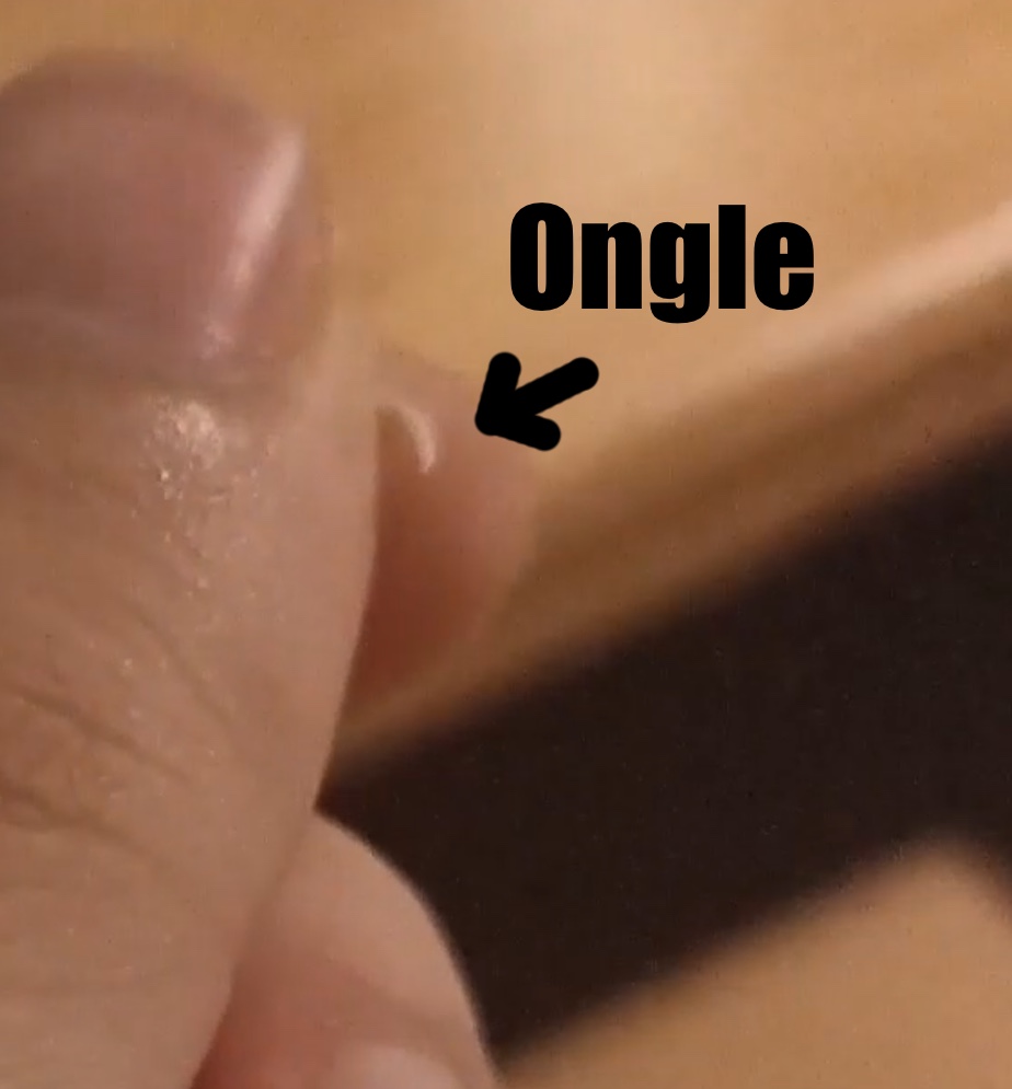 Un ongle
